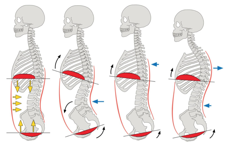 Different postures that may influence valsalva manuever in brass and wind players