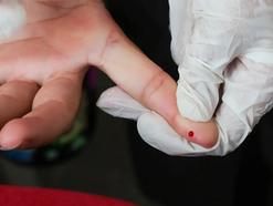 SUS passa a oferecer teste rápido para dengue