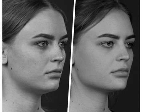 FACE SCULPTING