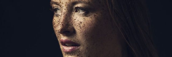 What I Want Others to Know About Mast Cell Activation Disorder