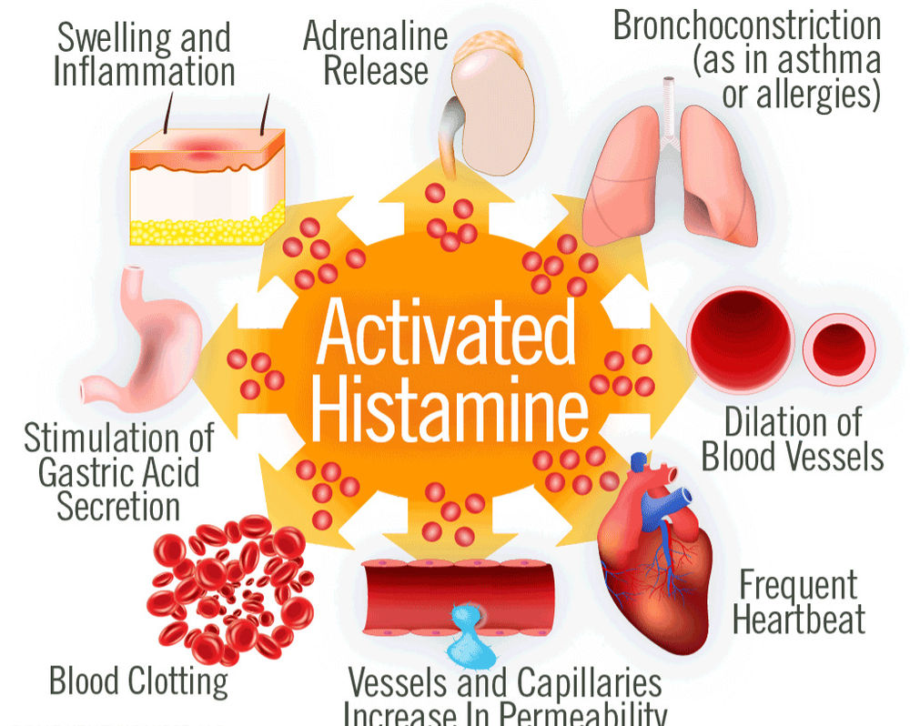 Histamine The Good, Bad, & How to Fix it.
