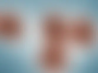 SMON, the Virus that wasn’t