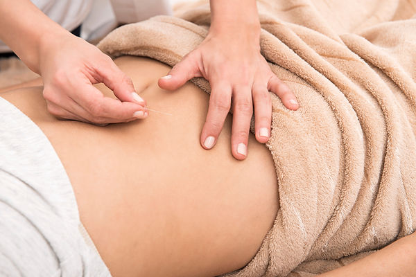 Akupunkturbehandlung mit feiner Nadel in der Naturheilpraxis Doson in Oberursel bei Frankfurt