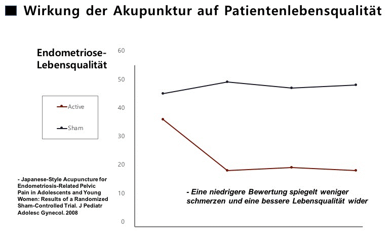 Endometriose TCM Akupunktur zur Erhöhung der Lebensqualität