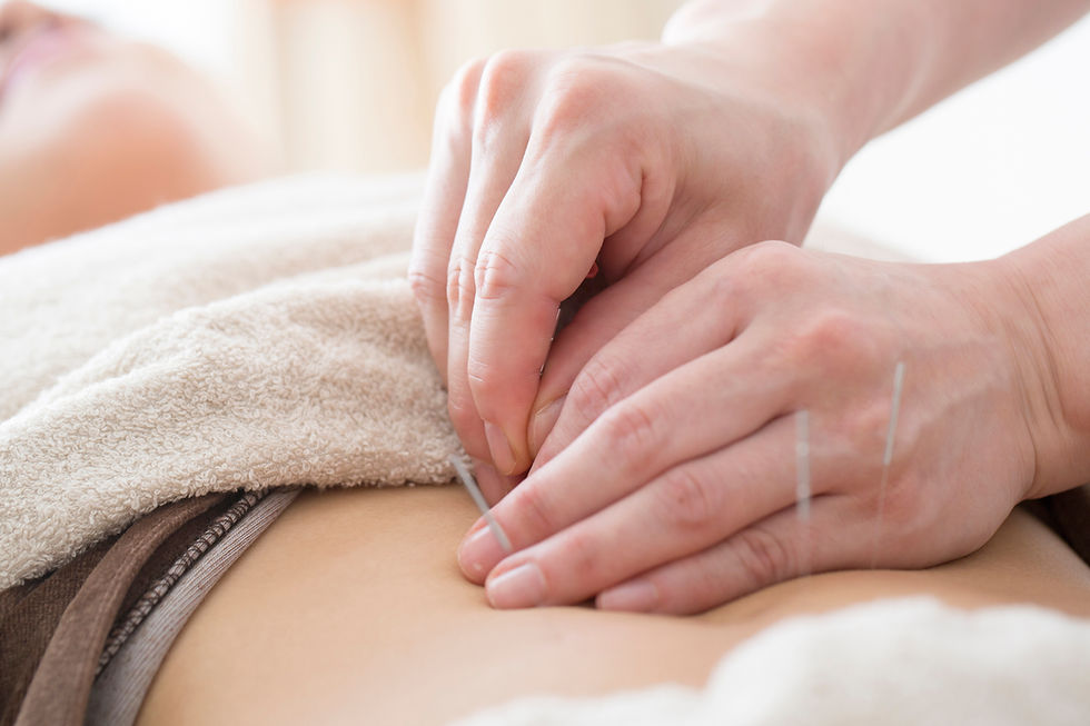 Akupunkturbehandlung bei PCOS und unerfülltem Kinderwunsch – TCM unterstützt Eisprung, Gebärmutterschleimhaut und Gelbkörperphase in der Naturheilpraxis Doson Frankfurt und Oberursel
