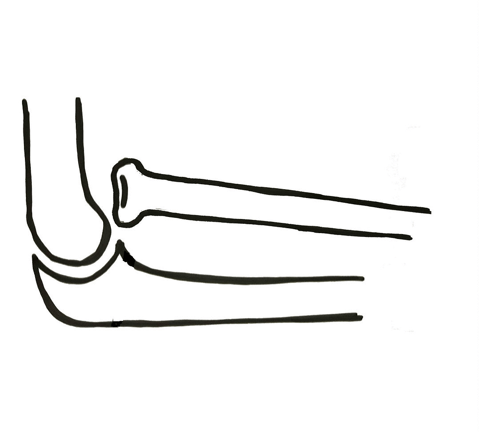 GIF surgical procedure take 1.gif