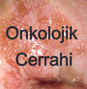 HSIL görüntüsü