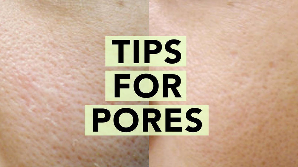Why are my pores large? What should I do if my pores are thick and large?