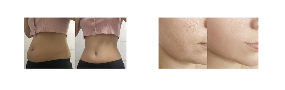 B&A-01.png