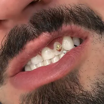 unique gold piece anchor tooth gem charm christchurch nz