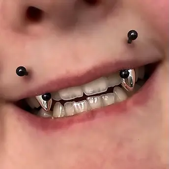vampire fang grill pointed canines Christchurch nz