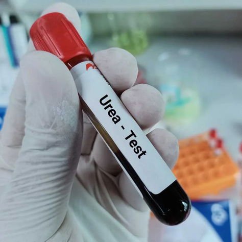 Know Your Blood Parameter: Urea