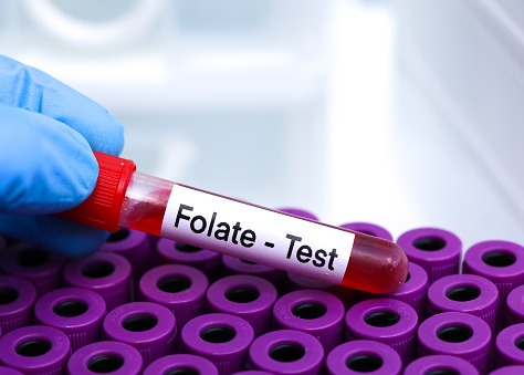 Know Your Blood Parameter: Folate (Vitamin B9)