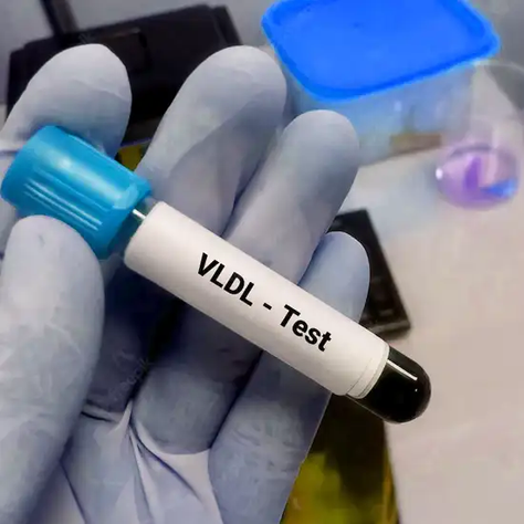 Know Your Blood Parameter : VLDL