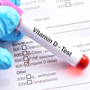Know Your Blood Parameter: Vitamin D (25-OH)