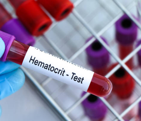 Know Your Blood Parameter : Hematocrit (HCT)