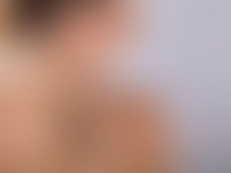 Tattooentfernung in Zürich mit Pico Laser – Sicher & hautschonend