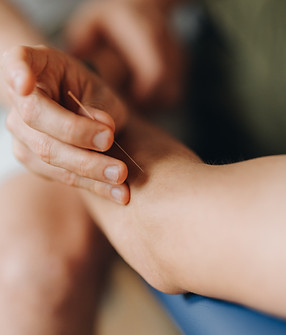 Naturheilkunde Akupunktur Regensburg.jpg