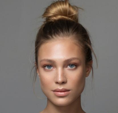 alopeciatracao.jpg