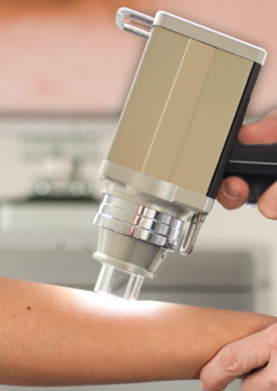 Dermatoscopia Digital e Mapeamento Fotográfico Corporal-DraPaulaYume.webp
