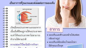 Retinal detachment
