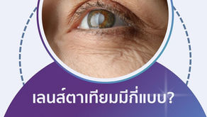 เลนส์แก้วตาเทียม