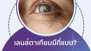 เลนส์แก้วตาเทียม