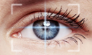 Keratoconus