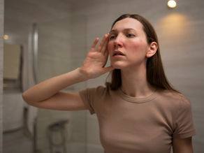 Beyond Skin Deep: Rosacea, Stress, and Unexpressed Emotions