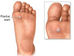 Facts about Warts