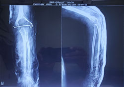 photo_2025-04-11_17-58-06 (2)