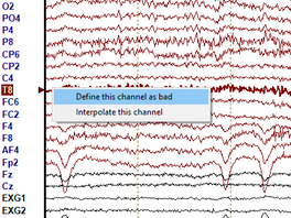 Delete or Interpolate Bad Channels