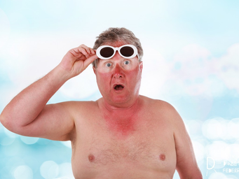 AIZSARDZĪBA NO SAULES