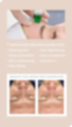 Is the Hydro2 Facial the Key to Youthful, Radiant Skin? A Closer Look at Skin Darras Hall's Rejuvenation Treatment