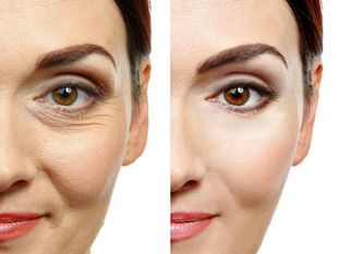 Polynucleotides: The Regenerative Skin Treatment at Skin Darras Hall