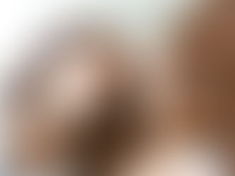 Efeito rebote ocorre em todo tipo de pele: aprenda a cuidar