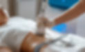 Ultrashape Cozumel treatment