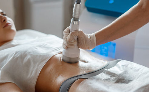 Ultrashape Cozumel treatment