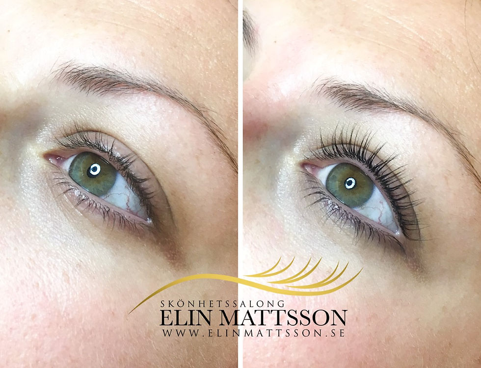 Lashlift