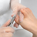 Toenail treatment with a nurse wearing gloves