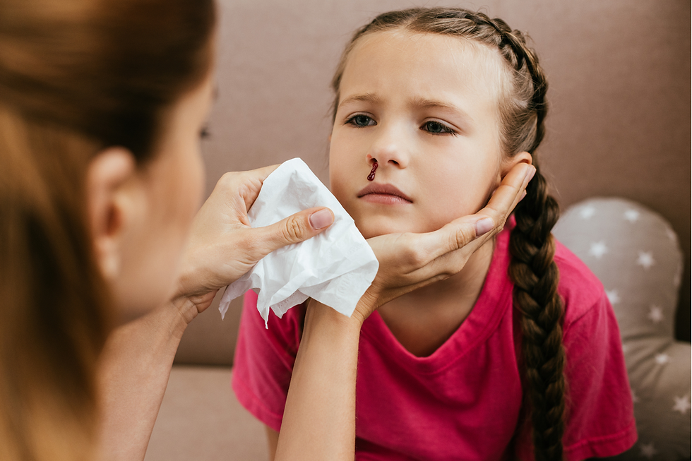 El sangrado de nariz en niños por temporada de calor es común y rara vez representa un problema grava de salud, simplemente hay que observar con cuidado si este dura y ocurre más de lo normal o se desconocen las causas.
