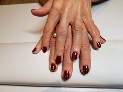 Ongles