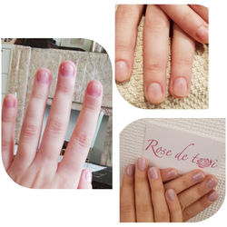 Ongles rongés
