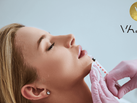 Benefits of Getting Lip Fillers from Our Clinic in Toronto