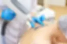 tattoo removal toronto