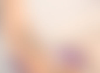 tattoo removal toronto