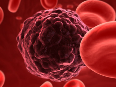Cancer in Society