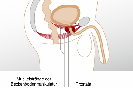 Inkontinenz Therapie mit dem QRS-PelviCenter