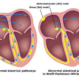 - Electrophysiology
