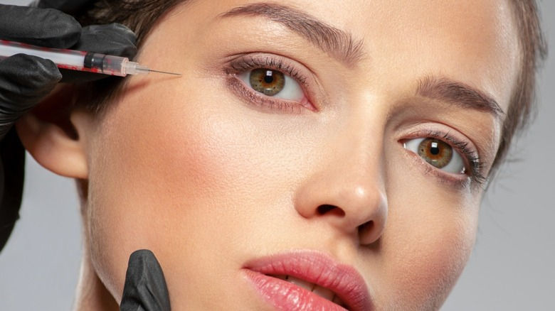 Under-Eye Filler Treatment in Dubai